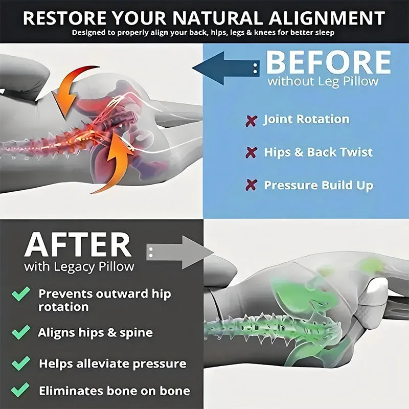 🛌 ErgoLeg™ Support Pillow – Relieve Sciatica, Hip & Back Pain 🌙✨